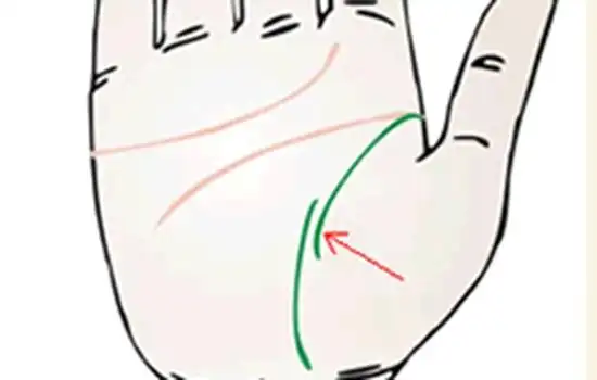 生命线断开有两条线生命线真性断开两条图解