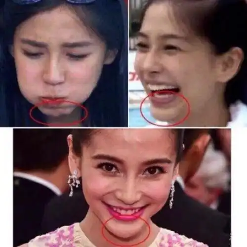 一直否认整容的杨颖,她的整容史都可以出一本书了