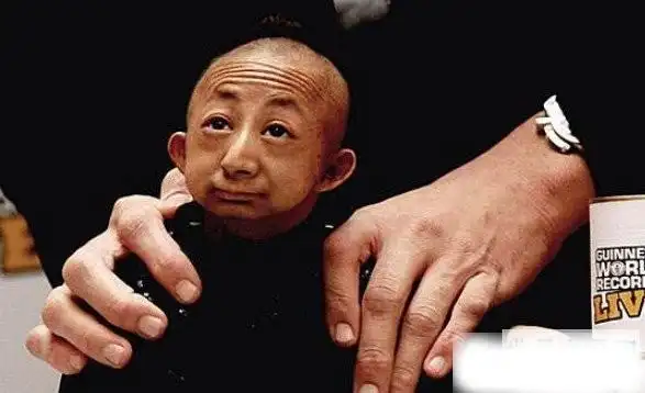 世界上体重最轻的成年人,26岁男子仅重11斤