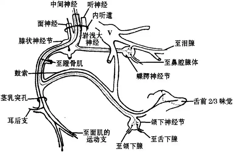 二,特发性面神经麻痹-神经病学-医学