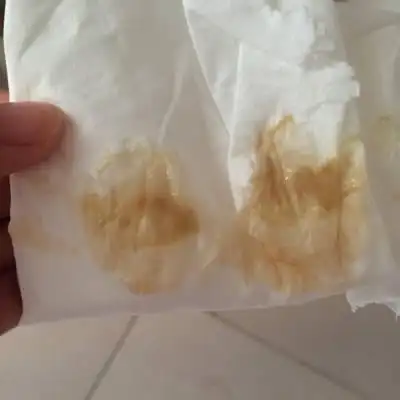 怀孕7周左右,早上上厕所的时候发现白带呈咖啡色,就像例假快过去的