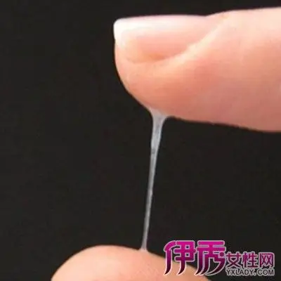 【图】展示正常排卵期白带图片 你知道白带拉丝是怎么回事吗?