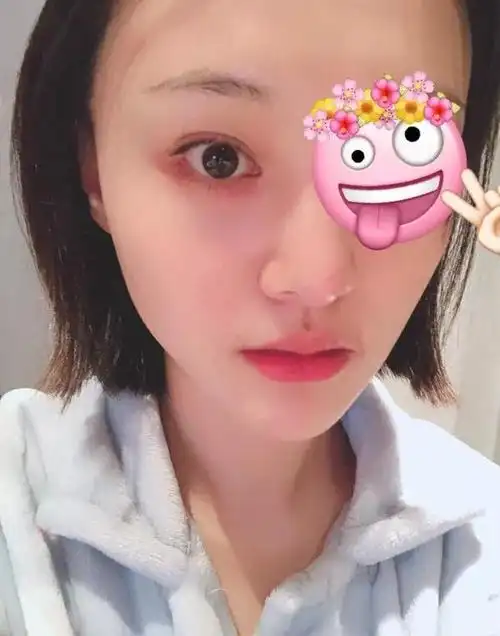 郑爽晒半脸自拍,牛奶肌肤败给了这个千年bug!