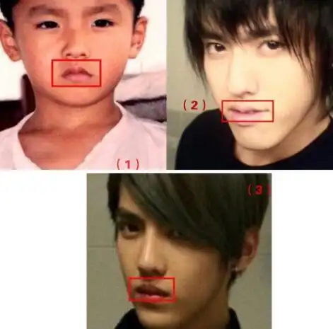 【图】吴亦凡整容前似路人 整容前后差距大的吓人!