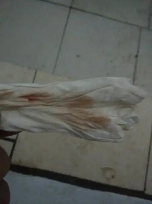 今早见红,不多,不肚子疼,不腰疼,是不是快要分娩的前兆,之后多久会生