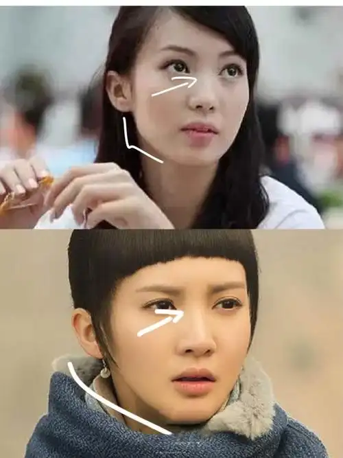 97金晨屡屡换头整成cheap脸6315.