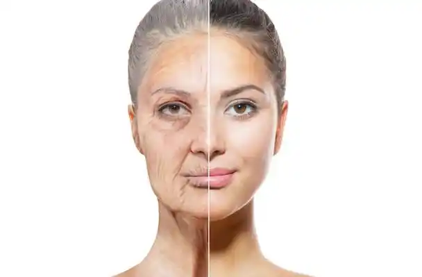 皮肤老化是一个复杂的生物学过程,强脉冲光可以改善面部肌肤问题