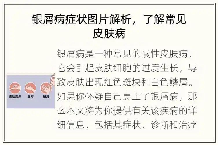皮肤百科知识分享-皮肤健康问题第一门户,免费提供专业的皮肤问题知识