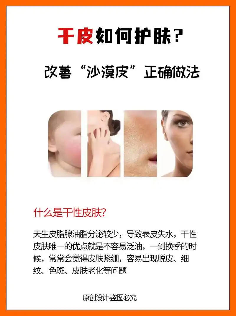 干皮护理的方法6015教你拯救沙漠大干皮6015.