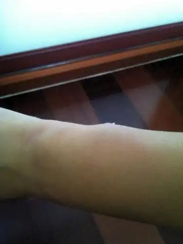 妈妈总是打我 这次拿的衣架打我 好痛的qaq 都有轻生的念头了qaq 我该