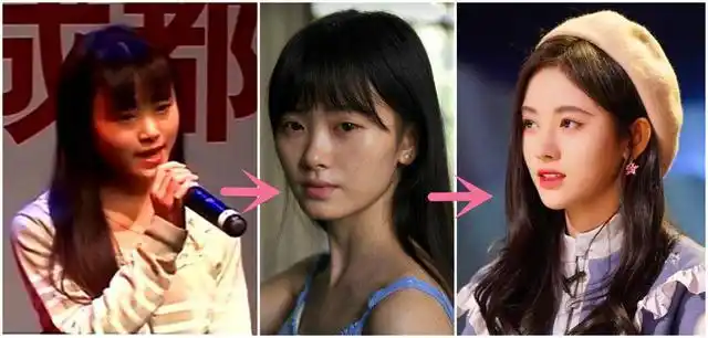 鞠婧祎颜值确实上乘,肯定算是美人一个,可是她早就被网友扒出是整容