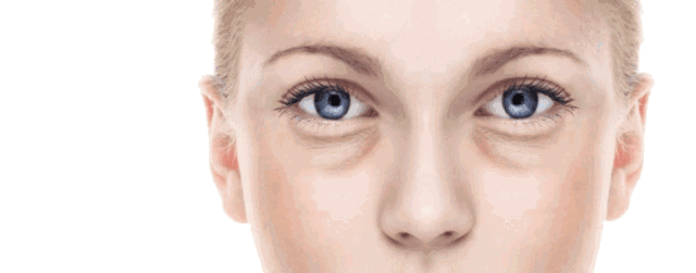 眼睑是什么眼睑是哪里图解