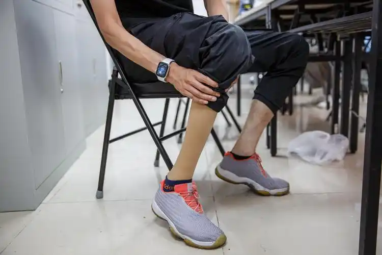 孙宏伟的右腿假肢.  新京报记者 王子诚 摄