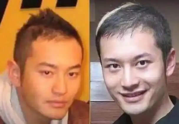 初见发如浓墨,再见秃头秃脑!这6位男星的头,让女人好心碎