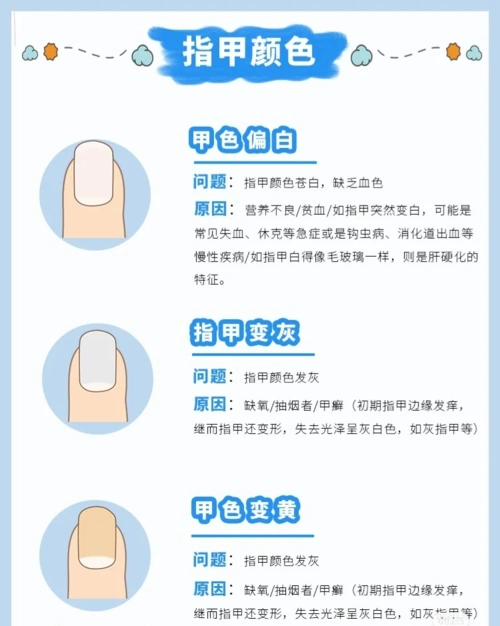 健康指甲具有哪些特征?