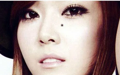 导致女人婚姻不幸财运不济的五颗痣,一定要去掉