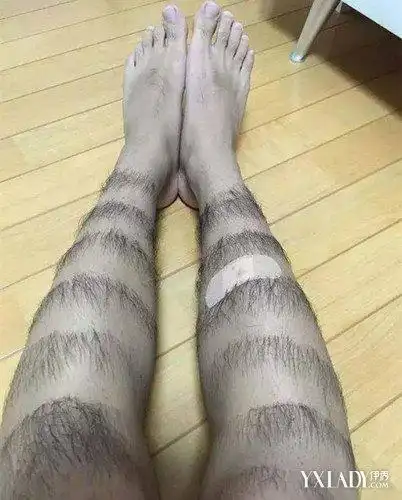 男生前卫腿毛爆红夏季脱毛什么方法好