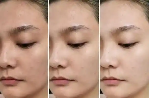 黄皮女生要知道的4个护肤方法建议坚持照着做皮肤会悄悄变白