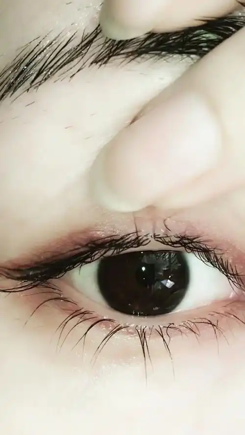 翻开眼皮,辨别真假!嫁接不可能种在毛囊里吧!自己养出来的真睫毛!