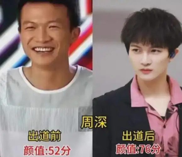 周深成名前后的变化有多大,干什么还得是专业团队.
