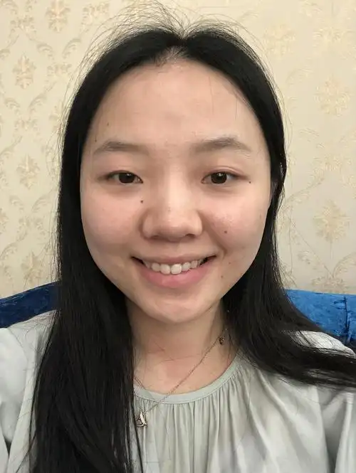 纯素颜 感觉自己越来越丑了 脸好大 感觉眼睛也太小了 想去开眼角 求