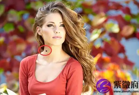 脖子上长痣是好事还是坏事注意痣的位置