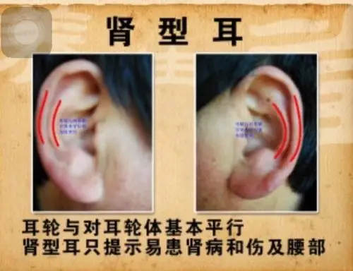 其它 神奇的耳诊 写美篇如何从耳朵看出身体的端倪呢?