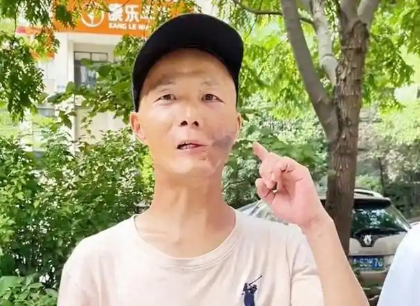 "槟榔四巨头":一天吃5包槟榔,两年死仨,剩下一个割舌保命|苏醒|彬彬