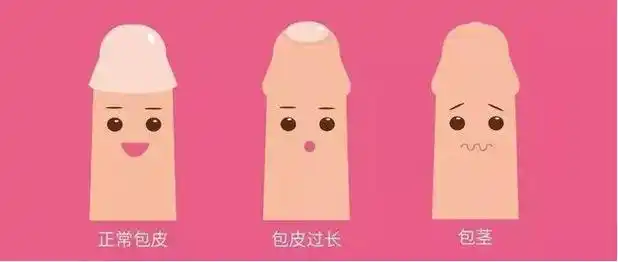 包皮手术的线多久脱落?_大同曙光男科医院-大同男科挂号—曙光男科