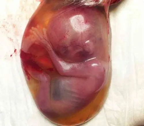 流产专家_治疗流产哪个专家好_治疗流产最好的专家/排行_有来医生