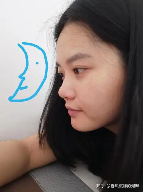 侧脸不好看怎么办?是哪里不协调或者是哪里有缺陷?