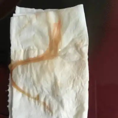 早上见红了,肚子一点都不痛,去医院医生说痛了再去