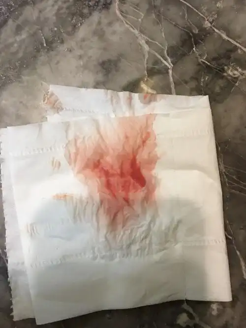 上次来例假是20号.白带没有异味没有豆腐渣