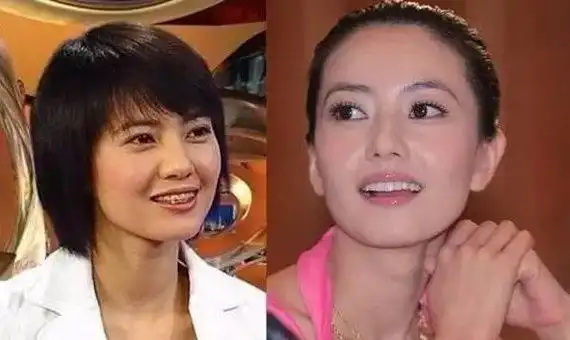 我们看看高圆圆箍牙后的颜值变化.最明显的一点就是法令纹.