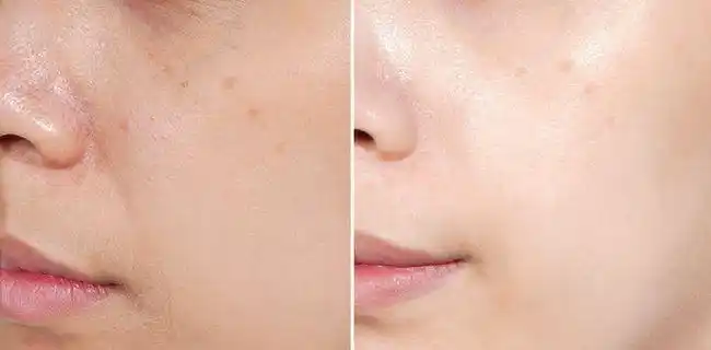 小米 我们的95后设计师,是个深夜下班还要追剧的狠人,毛孔大到能插秧