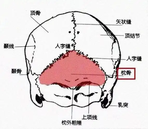 扁头就是枕骨的位置发育不足,涂红部位 民间所习称的睡扁头,被现发现