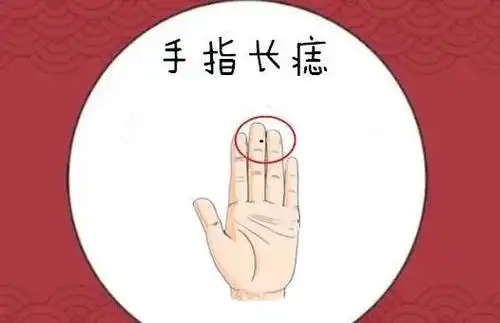 千金难买4颗痣,男人生财,女人生金,你知道是哪四颗吗?