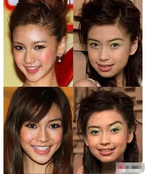 杨颖整容前照片牙齿