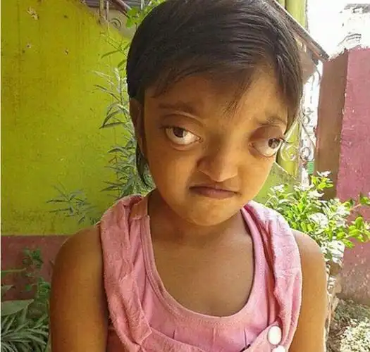 金鱼眼图片 金鱼眼睛凸出来了是怎么回事