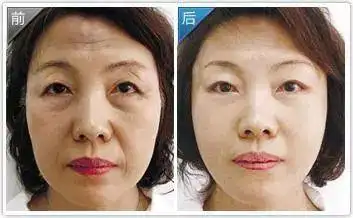 不打针不吃药每天一袋皮肤变得水嫩q弹细腻紧致比做了医美还惊艳