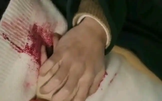 腹部受伤大力女子都奉顺代表为救女主受伤