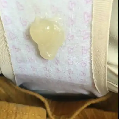 怀孕37 2早上发现这样的分泌物,是啥?