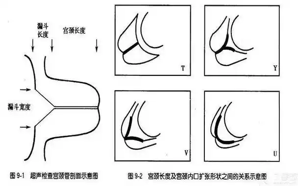 科普 | 告别孕期噩梦!