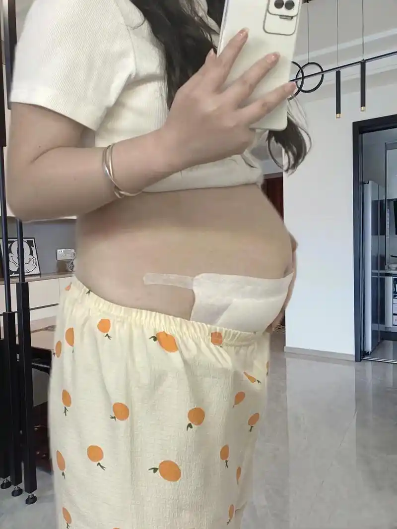 二剖,奉劝准备剖腹产的姐妹注意这些