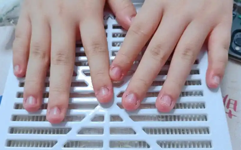 啃咬甲前后对比