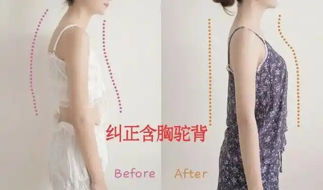 跟驼背说拜拜气质女人要放得开穿隐形神器肩背自然挺起来