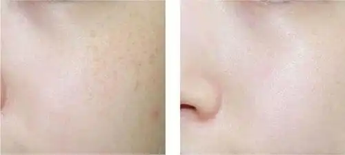 这款国货太争气了!平价却能解决"暗沉脸",皮肤越敷越白净