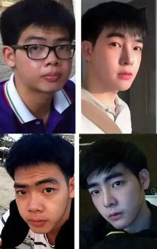 小哥花74万整容从丑男变网红