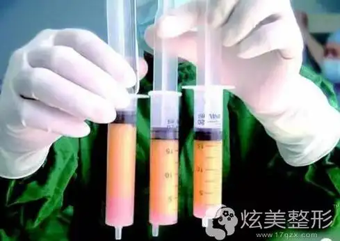 刚吸出来的脂肪展示