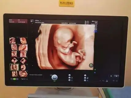 一般怀孕多久做四维检查最合适?